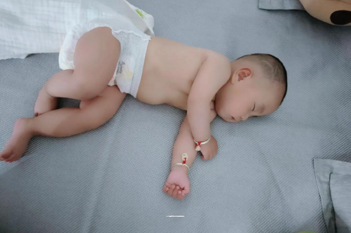 专业试管借卵代怀机构宝宝头上长痱子
